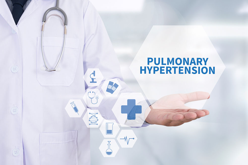 Pulmonary arterial hypertension – Causes, symptoms, and preventive measures